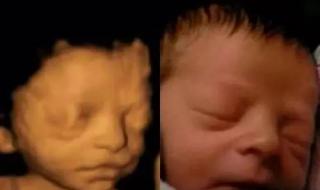 四维彩超官宣文案 胎儿四维彩超照片